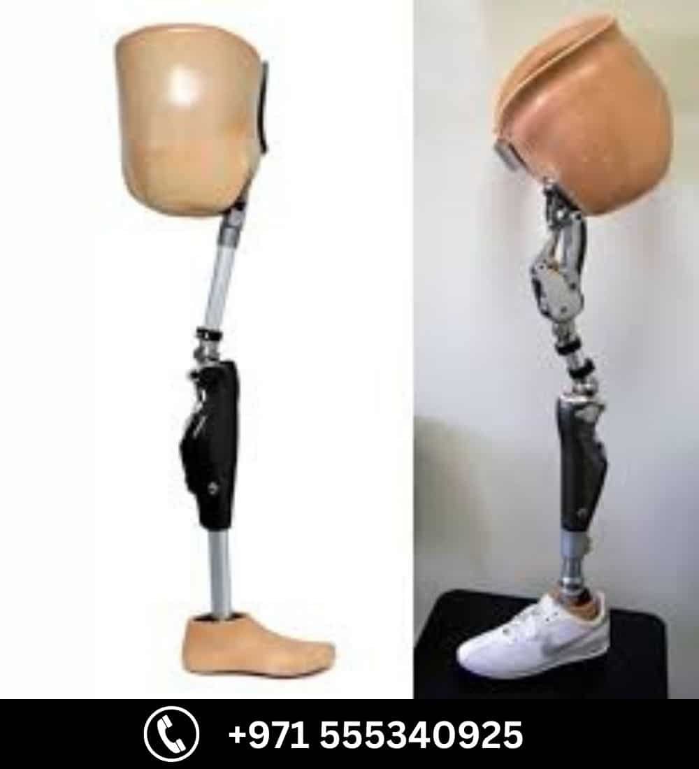 Hip Disarticulation Prosthesis — prosthetic in Dubai | Steps Creators UAE — View 4