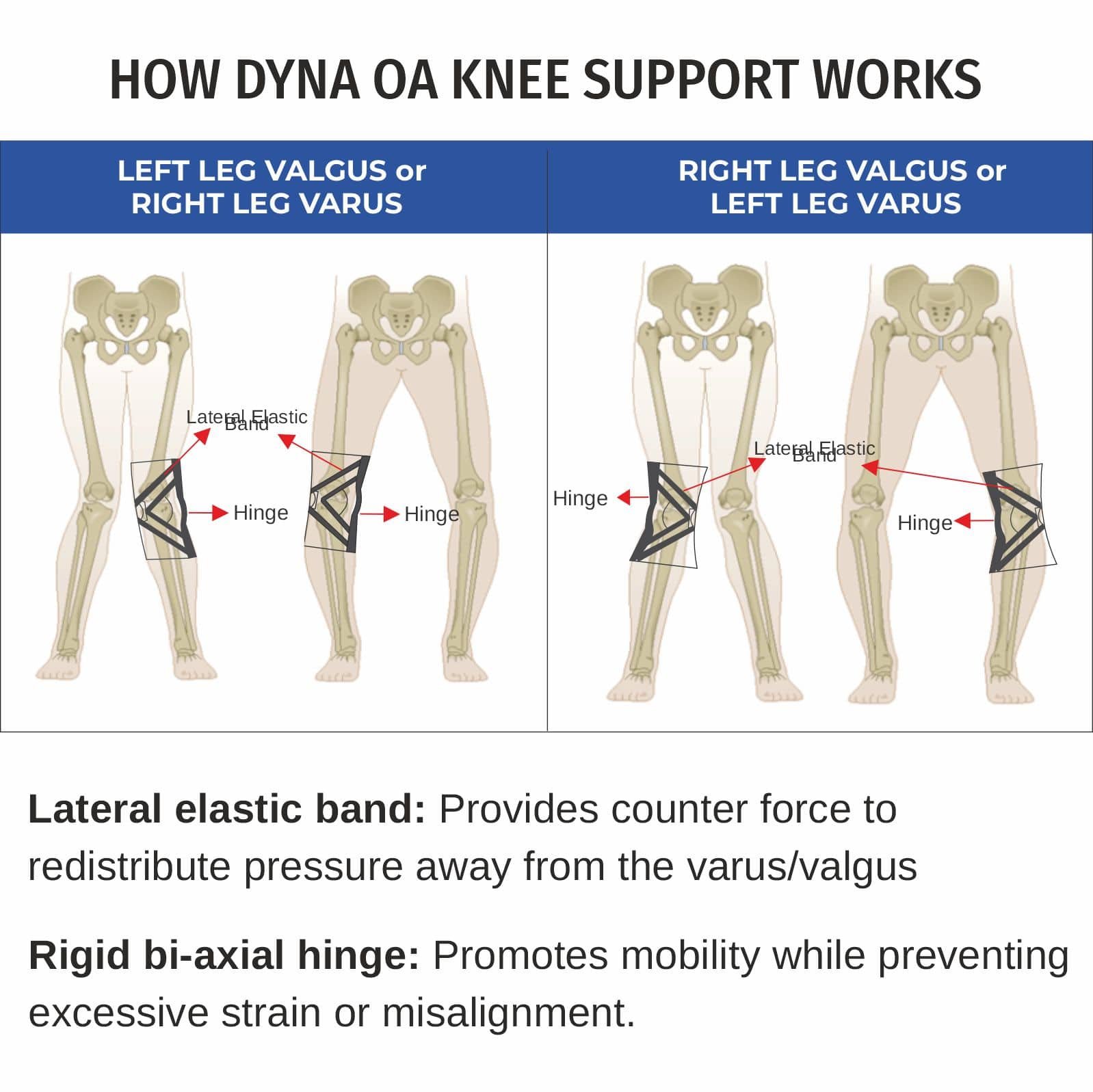 OA Knee Support — Hinged Knee Braces in Dubai | Steps Creators UAE — View 5