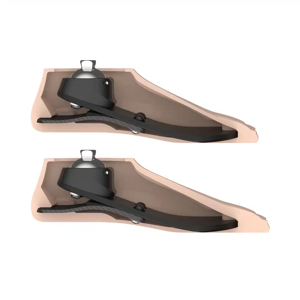 Scout Foot — prosthetic in Dubai | Steps Creators UAE