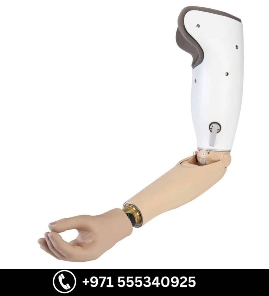 Above-Elbow Cosmetic Hand - Above Elbow Prosthetic available at Steps Creators Dubai, UAE