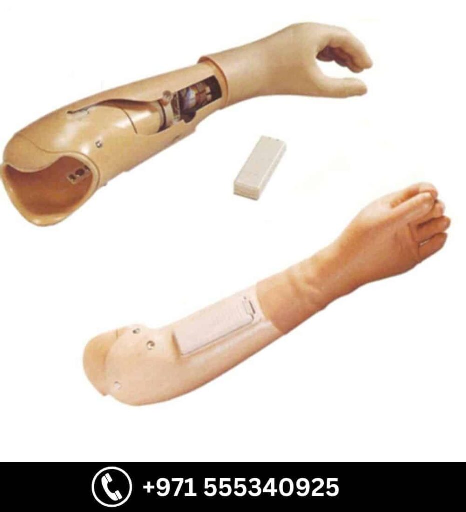 Myo Electric Hand - Prosthetic & Orthotic available at Steps Creators Dubai, UAE