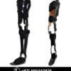 Knee Ankle Foot Orthosis (KAFO) — Lower Limb in Dubai | Steps Creators UAE