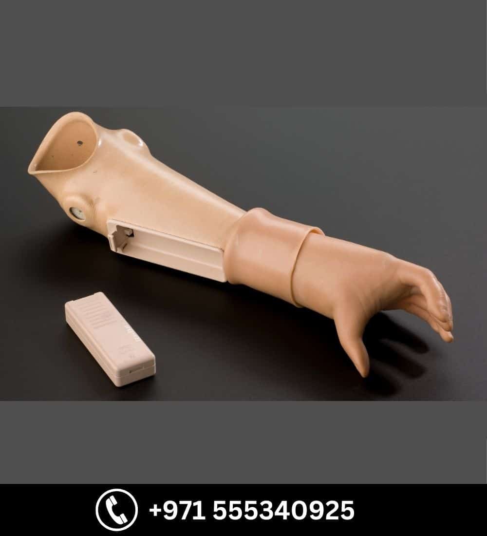 Myo Electric Hand — Prosthetic & Orthotic in Dubai | Steps Creators UAE