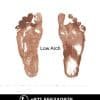 3D Print Custom Made Insole — Lower Limb in Dubai | Steps Creators UAE