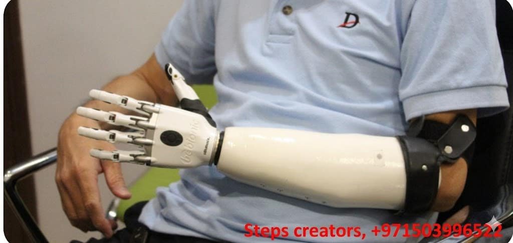Bebionic Hand - Below Elbow Prosthetic available at Steps Creators Dubai, UAE