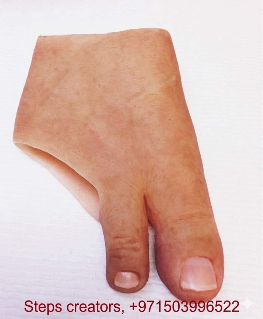 Silicone Toe Prosthesis - Orthotics available at Steps Creators Dubai, UAE