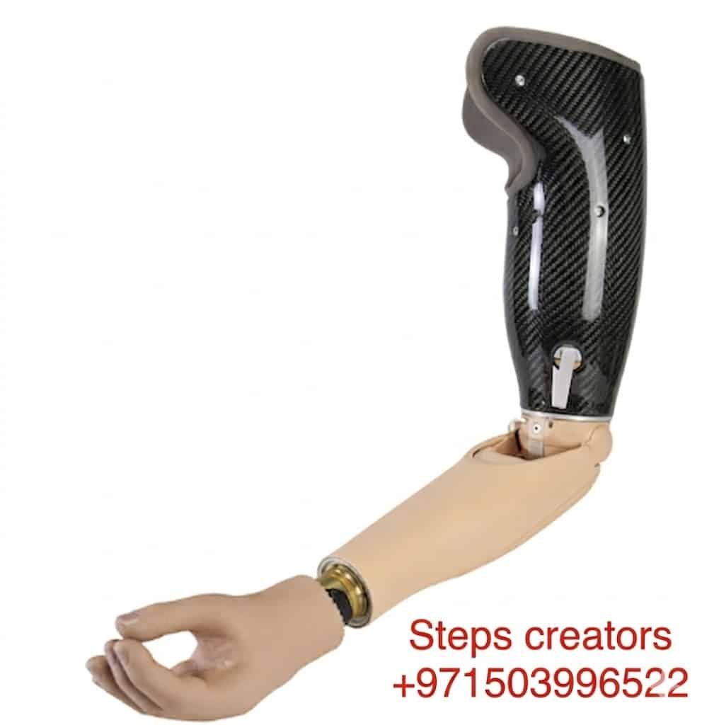 Above-Elbow Prosthesis (Transhumeral Prosthesis) - Above Elbow Prosthetic available at Steps Creators Dubai, UAE
