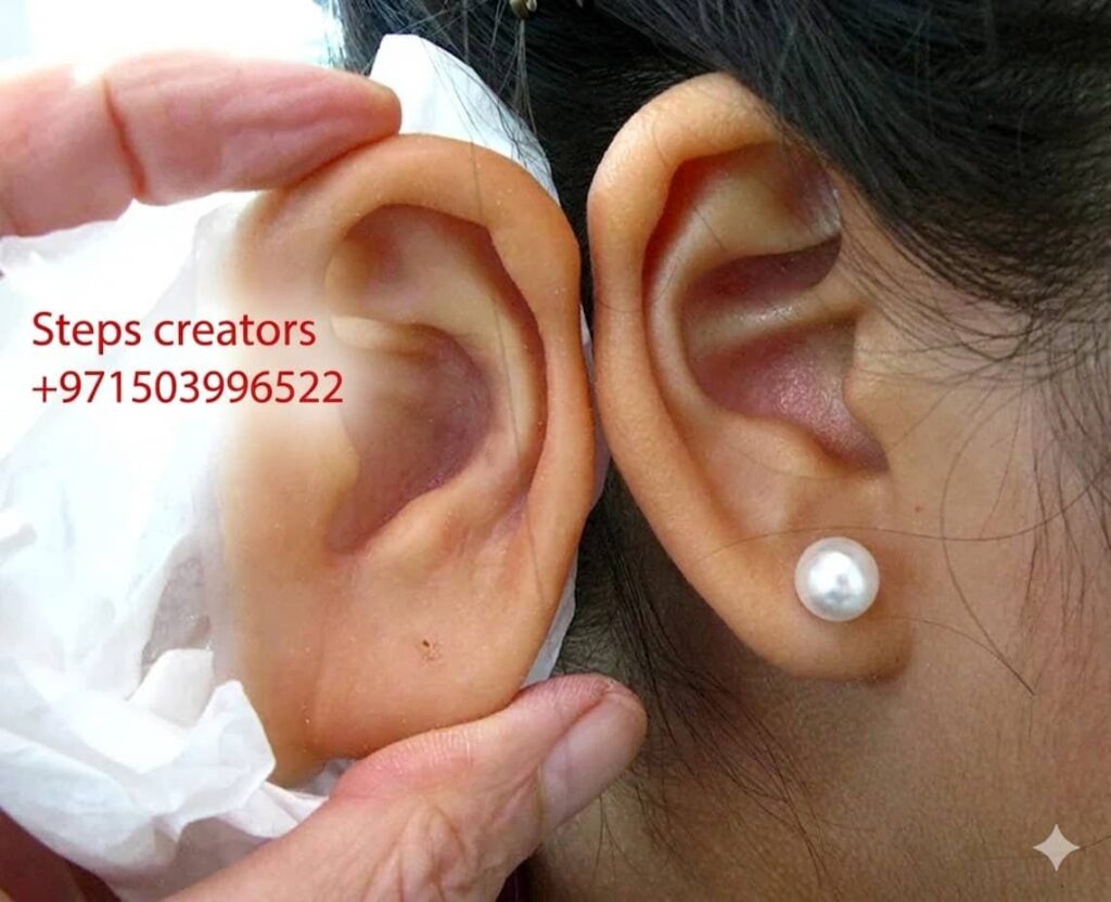 Silicone Ear Prosthesis (Auricular Prosthesis) - Orthotics available at Steps Creators Dubai, UAE