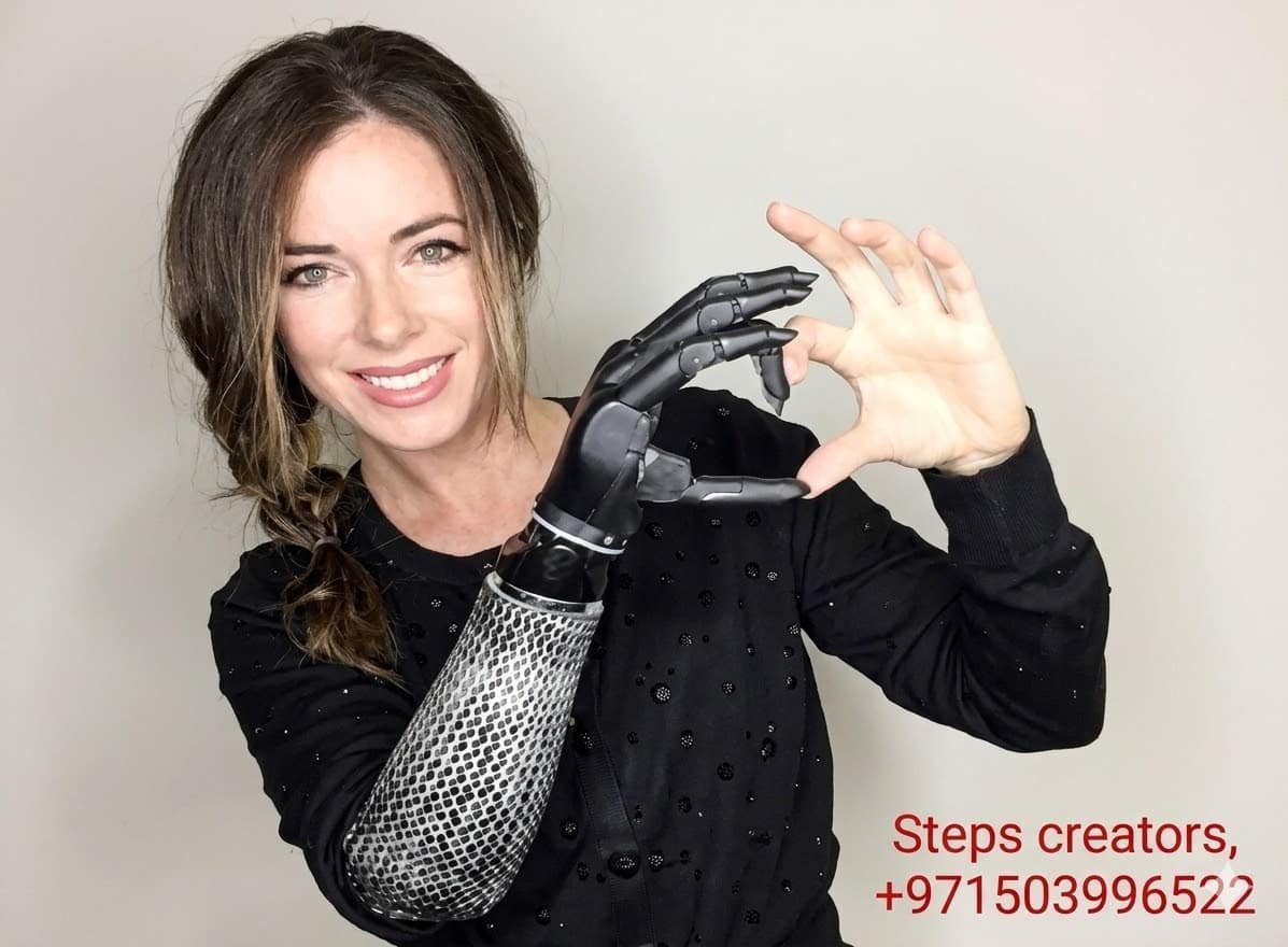 Touch bionic hand - Below Elbow Prosthetic available at Steps Creators Dubai, UAE